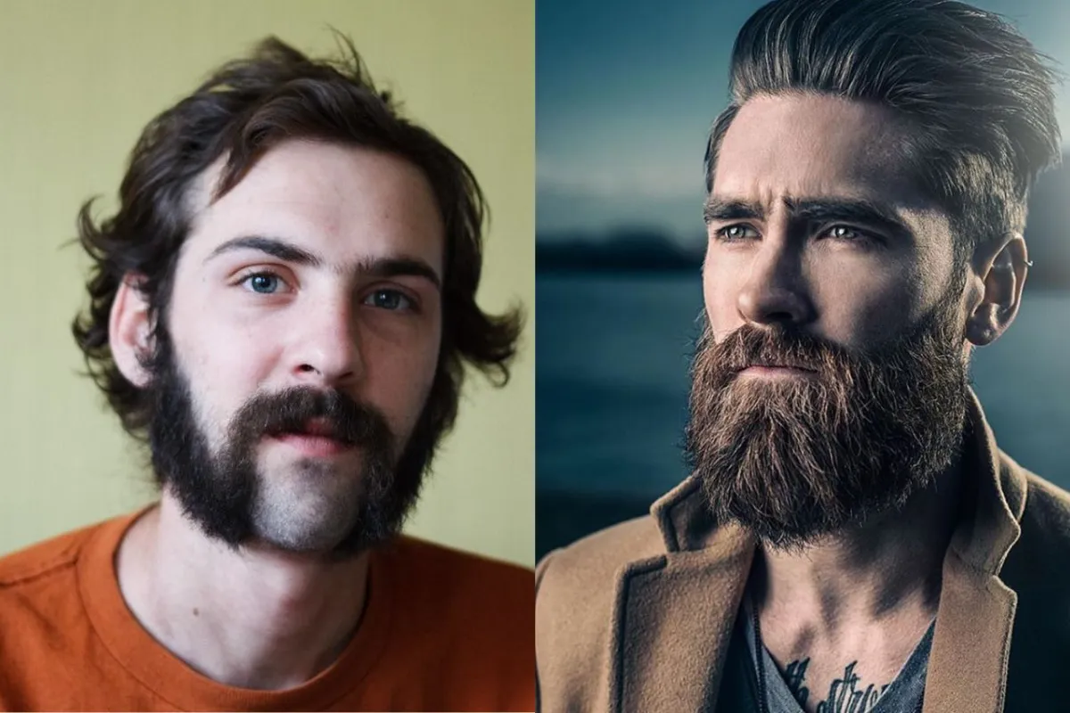 round face beard styles 2024