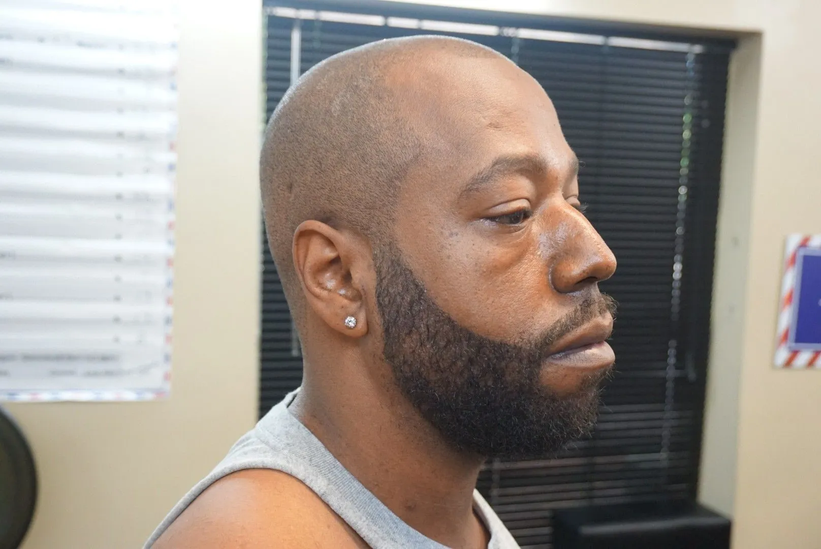 Rounded cheek line beard